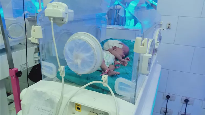 إجراء جراحة عاجلة متقدمة بالمخ لطفلة عمرها ١١ يوما بمستشفي فاقوس النموذجي