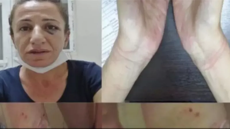 بالصور.. تعذيب سياسية معارضة يشعل الشارع التركي