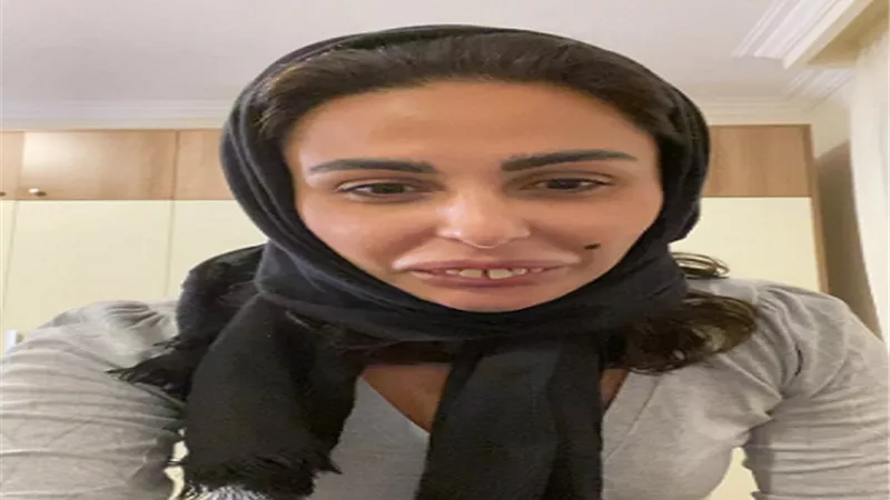 موجة انتقادات حادة لميس حمدان بعد تنمرها على الفتيات المحجبات أصحاب الأسنان غير المتناسقة.. فيديو
