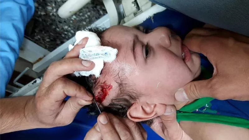 إصابة طفل جراء سقوط صاروخ على منزله بالعراق