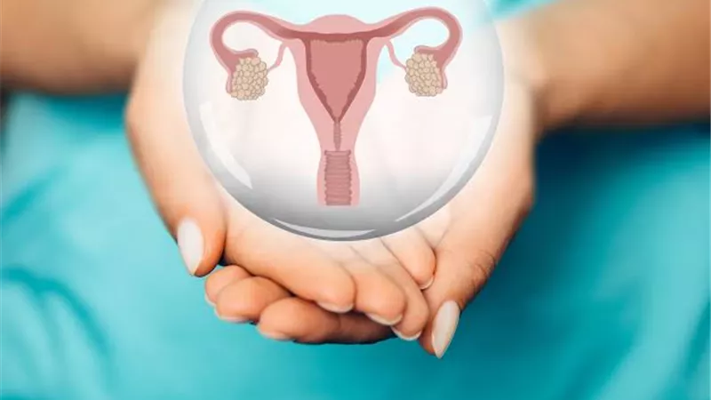 احذري الأخيرة.. 3 درجات مختلفة لـ تكيس المبايض