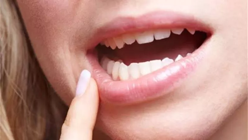 أكياس الشاي علاج سحري لتورم اللثة