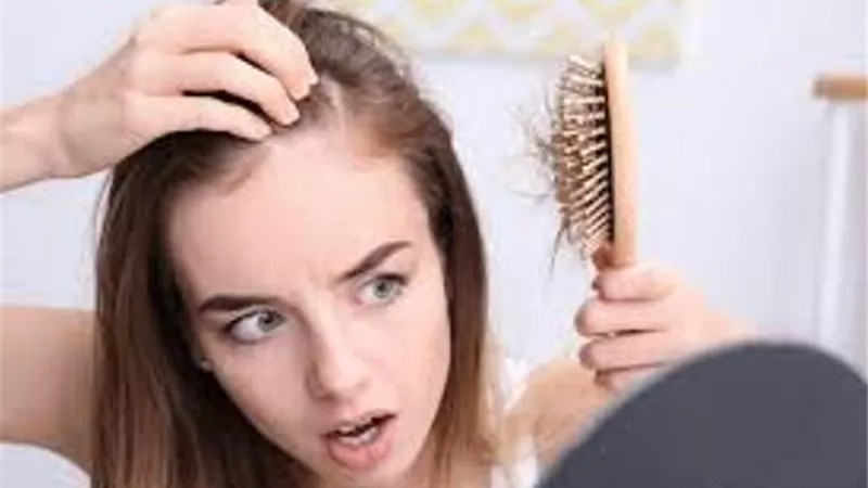 5 أسباب تؤدي إلى تساقط الشعر
