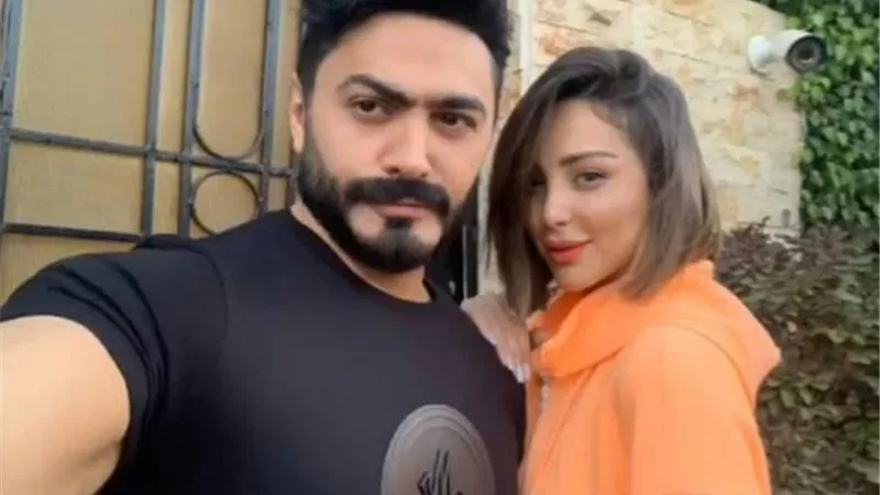 أول تعليق من تامر حسنى بعد تعرض كلبه زوجتة للعض
