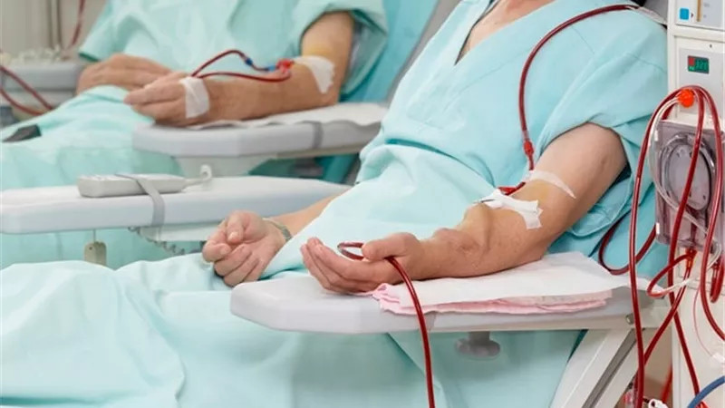 الحكومة تكشف حقيقة انباء العجز في أدوية مرضى القصور الكلوي بالمستشفيات الحكومية
