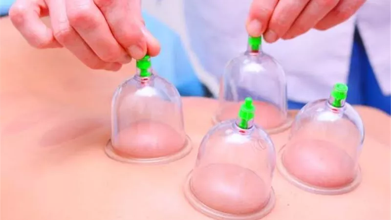 مشاكل صحية تسببها الحجامة