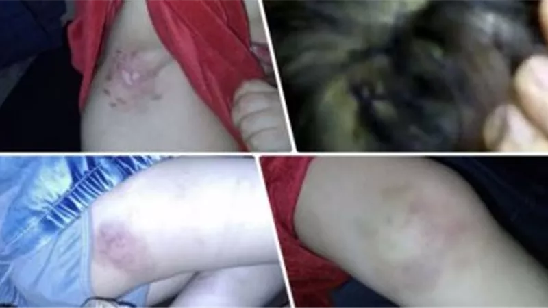 «واقعة مأساوية».. محضر شرطة يتهم صاحب مزرعة بتقييد وتعذيب طفل بسبب أخذه «ثمرة» في الشرقية