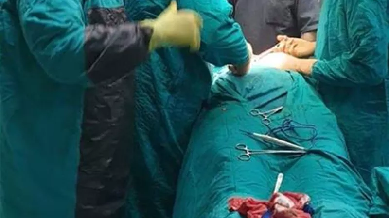 إستئصال مرارة لسيدة بعد تجهيزها وعلاجها من كسل وظائف الكبد بمستشفي دهب المركزي