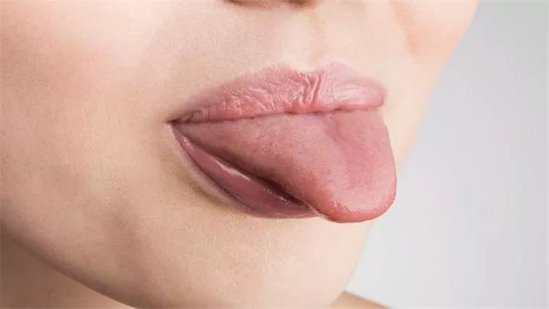 لسانك يمكنه التنبوء بأشد انواع السرطان .. تعرف على التفاصيل