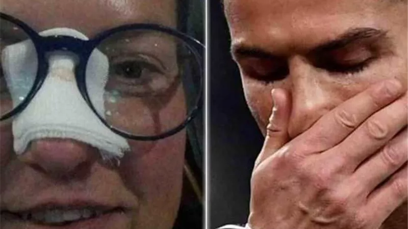 قميص رونالدو لم يرضى مشجعة بعد كسر أنفها
