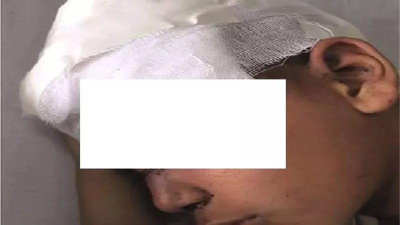 يهشمان راس طفل بعد فشلهما سرقه والده