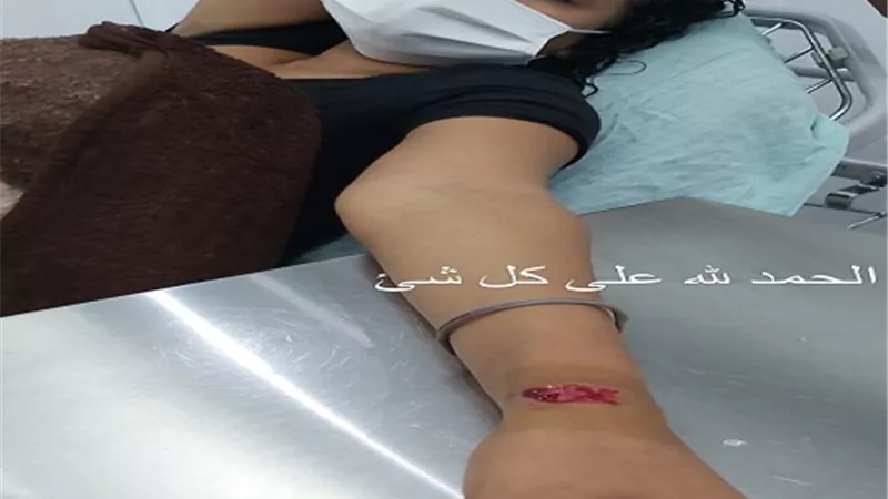 بعد إصابتها فى انفجار بيروت.. معلومات عن الفنانة نانسي صلاح