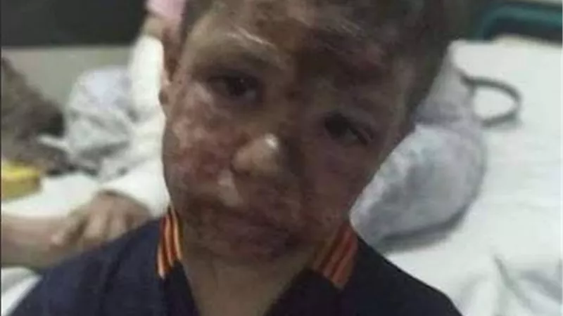 حبس المتهمين بإلقاء 