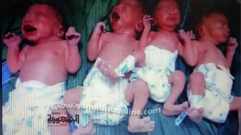سيدة تنجب 4 توائم بمستشفى أرمنت التخصصى بالأقصر
