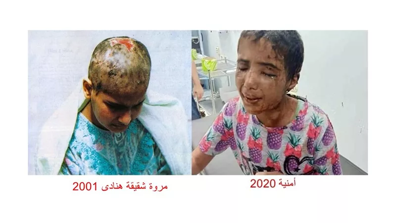 أشهر قضايا تعذيب الخادمات .. من هنادى وفاء مكى إلى أمنية كفر الشيخ جحيم الأثرياء مسلسل رعب لاينتهى .. صــــور