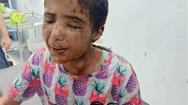 حبس المتهم فى تعذيب طفلة كفر الشيخ 15 يوماً على ذمة التحقيق