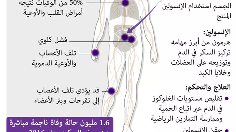 بالانفوجراف ..كل ما تريد معرفته عن مرض السكرى