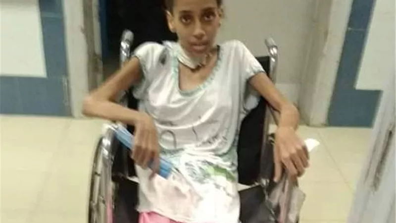 مناشدة أم لوزيرة الصحة.. انقذوا حياة الاء