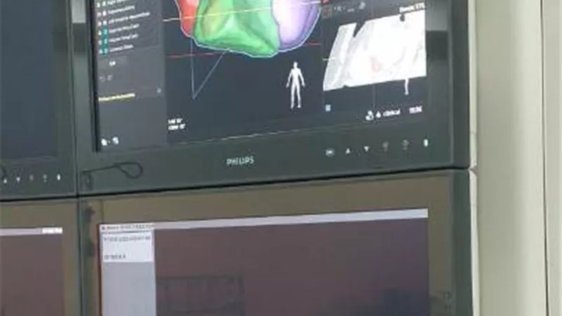 دعم مستشفيات جامعة الزقازيق بجهاز قسطرة قلب الأطفال الجديد بتكلفة ١٠ مليون جنيه