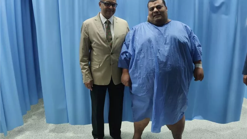 نجاح جراحة تحويل المعدة ل 
