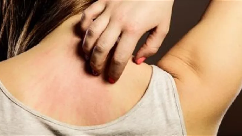 8علامات جلدية تدق ناقوس الخطر لمشاكل مرضية حادة داخل جسمك