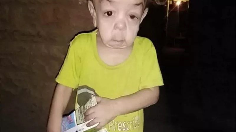 الاستغاثة الطبية بمجلس الوزراء تستجيب لعلاج الطفلة 