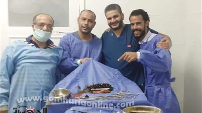فريق جراحي بالإسماعيلية يستأصل مرارة مريض بها مئات الحصوات.صور