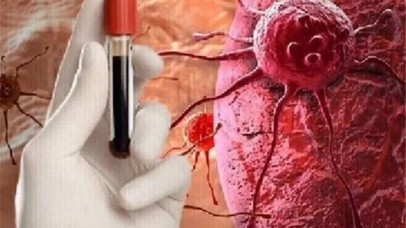 انتبه ..اعراض تكشف سرطان الدم