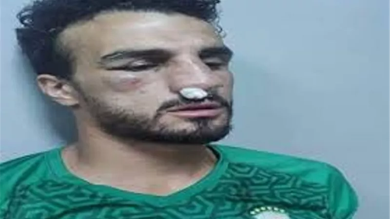 عملية جراحية لـ محمود رزق مدافع الاتحاد بعد اصطدامه بأحمد فتحى