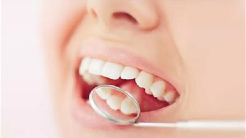 بدون الرجوع الى الطبيب المختص اكتشف مدى صحة اسنانك