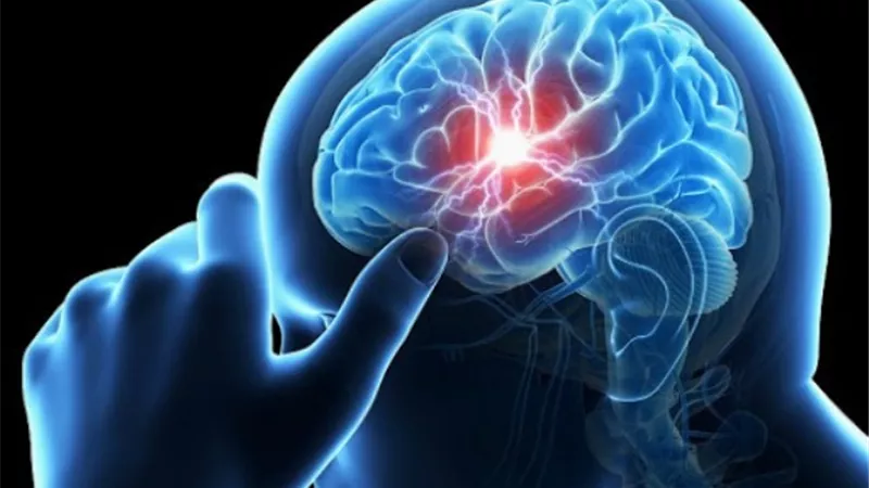أعراض خطيرة تعرضك لجلطة دماغية وشيكة.. احذرها