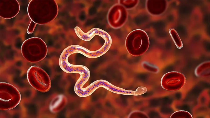 لدغات بعوض تحول قدم رجل الى 5 أضعاف حجمها