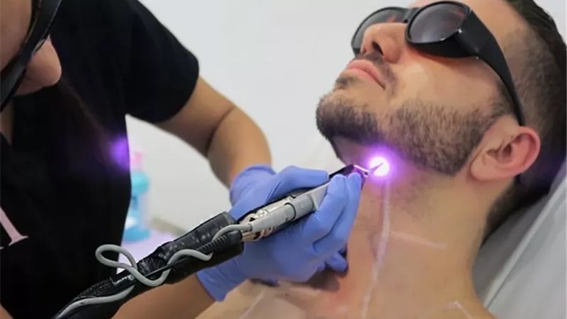فيلر وغمازات.. لماذا يلجأ شباب سعودي لعمليات التجميل ؟