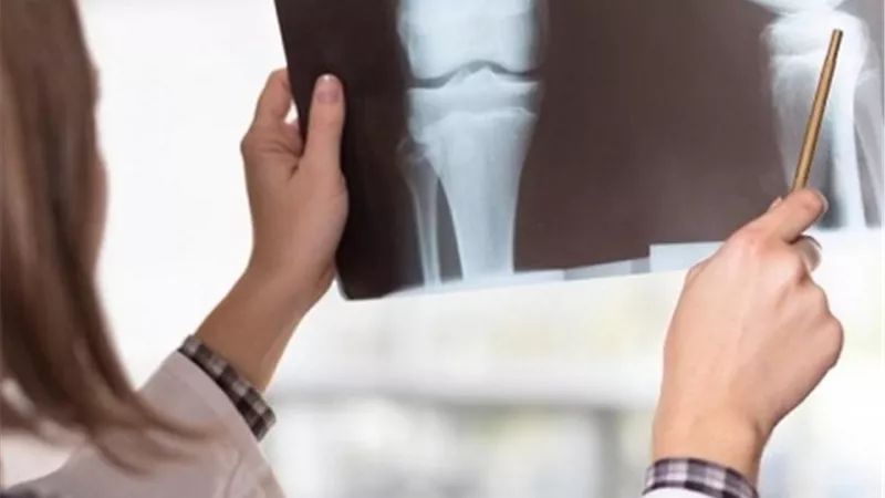 تعرفي على اسباب هشاشة العظام وكيفية العلاج