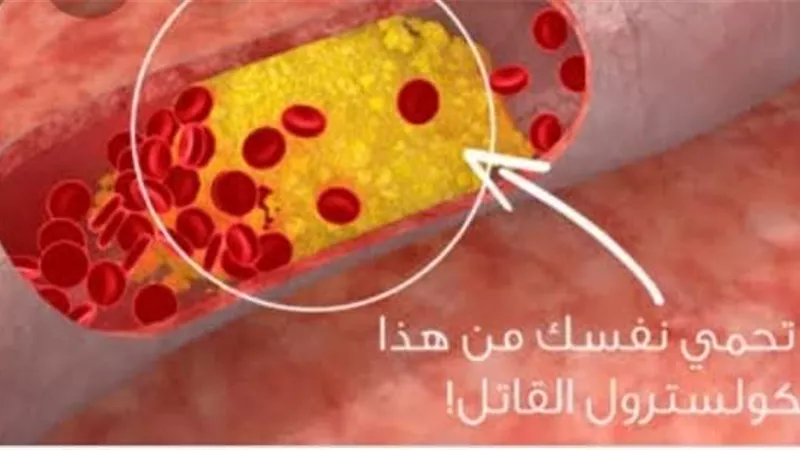 خبيرة تغذية تكشف عن سبب زيادة كوليسترول الدم عند الاطفال.. وطرق علاجه
