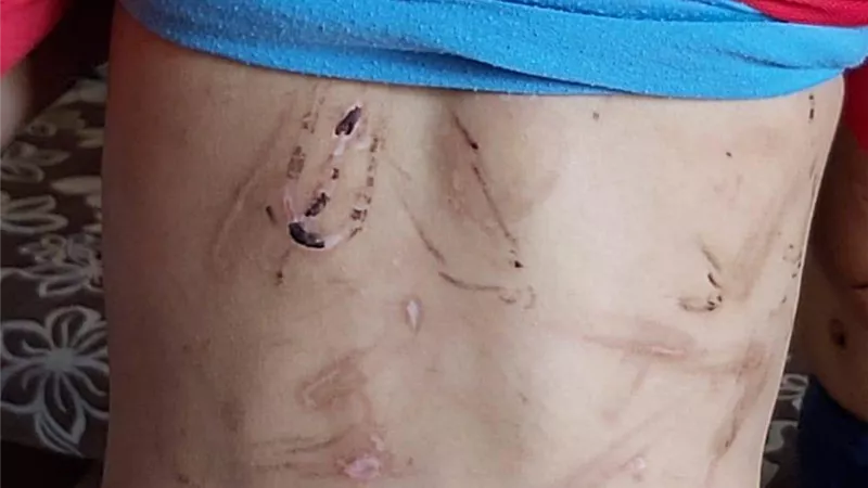 حبس زوج الأم المتهم بتعذيب أولاد زوجته بقليوب 15 يوم علي ذمة التحقيقات