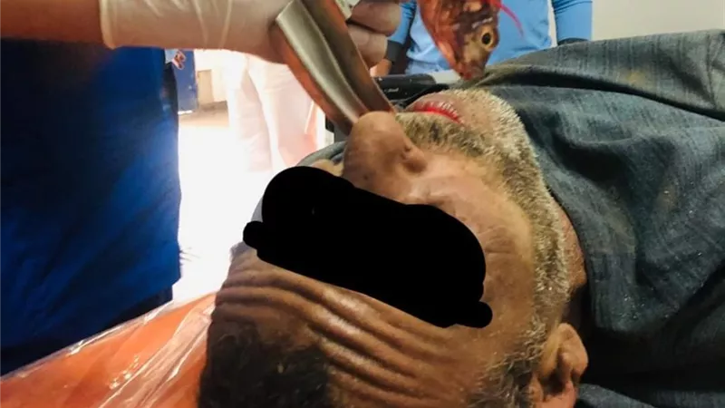 انقاذ صياد أبتلع سمكه حيه فى بنى سويف