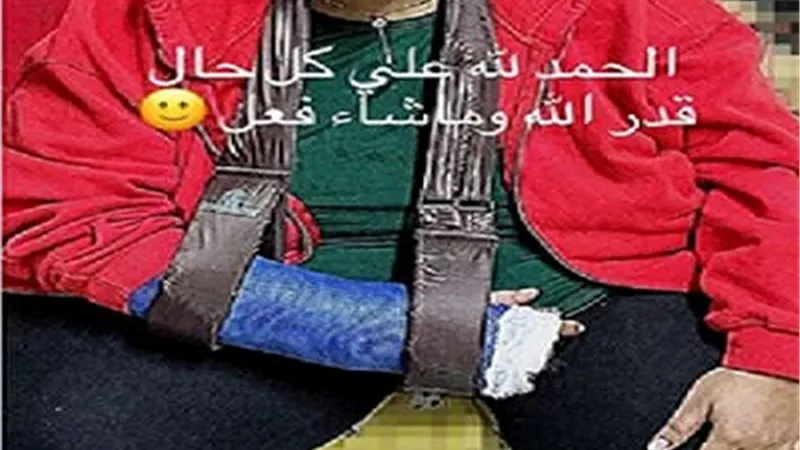 إصابة ويزو بكسر فى ذراعها الأيمن