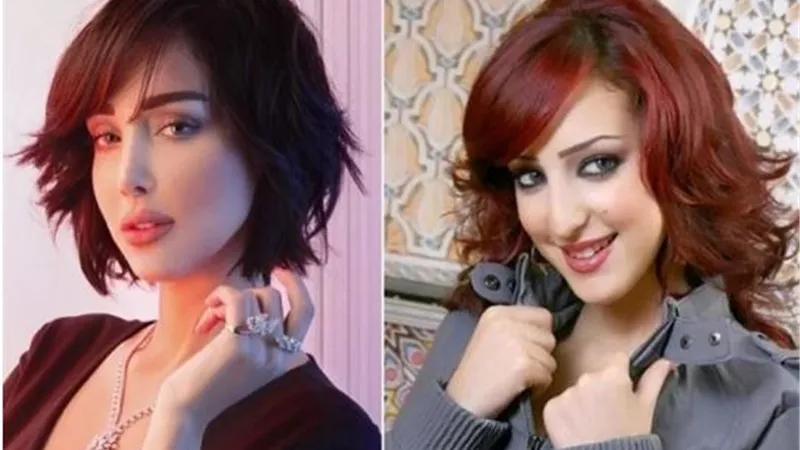 طليقة تامر حسنى قبل وبعد عمليات التجميل