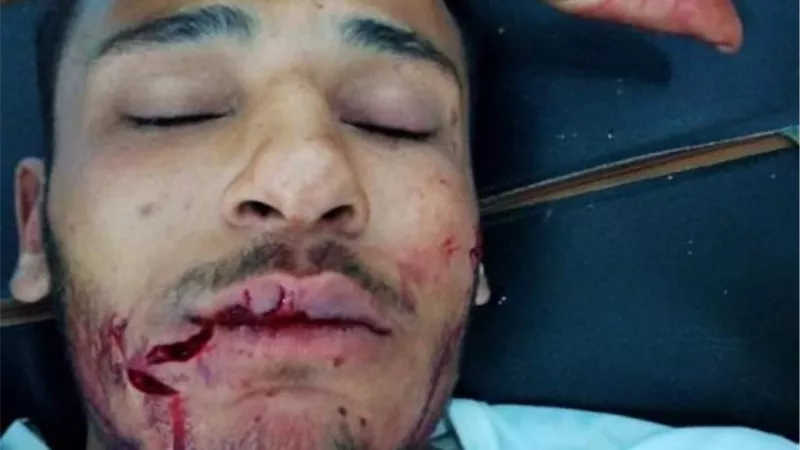 كلب ضال يعقر 4 مواطنين بينهم طفل في الدقهلية