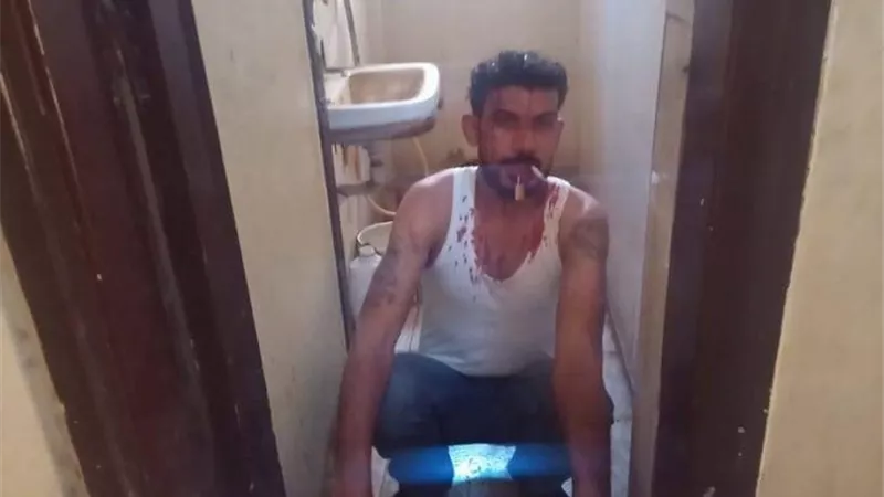 شاب يغلق فمه بـ