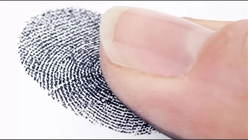 طفرة فريدة ...عائلة لاتمتلك بصمات اصابع