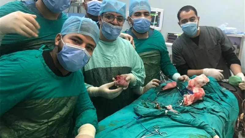 جراحة نادرة بمستشفيات جامعة المنيا لاستئصال توأم مسخي ملتصق لطفلة في أسبوعها الأول من أم مصابة بكورونا