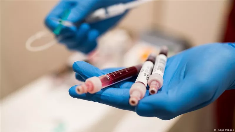 الصحة العالمية تعلن موقف توزيع لقاحات كورونا فى مؤتمر صحفى اليوم