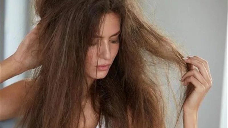 مستشارة طبية تكشف عن علاج تساقط الشعر وتقصفه