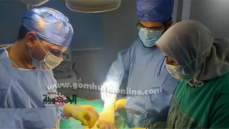 استئصال مرارة لشابة بها عدد كبير من الحصوات المرارية