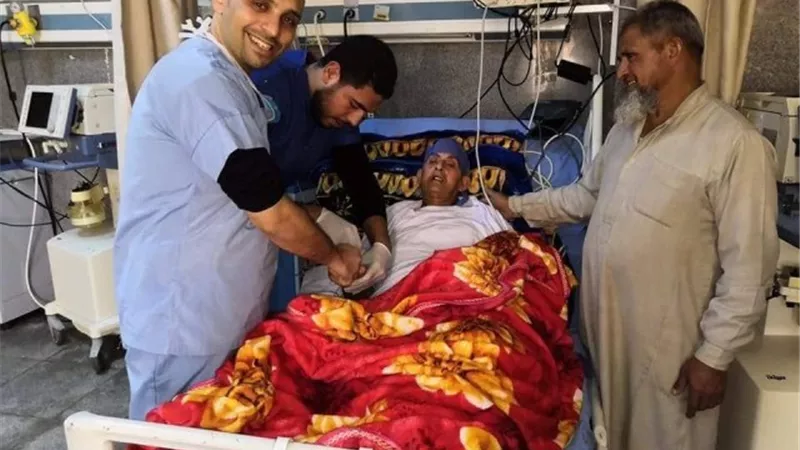 بنها الجامعى تجري جراحة شق صدري محدود لاول مرة في مصر