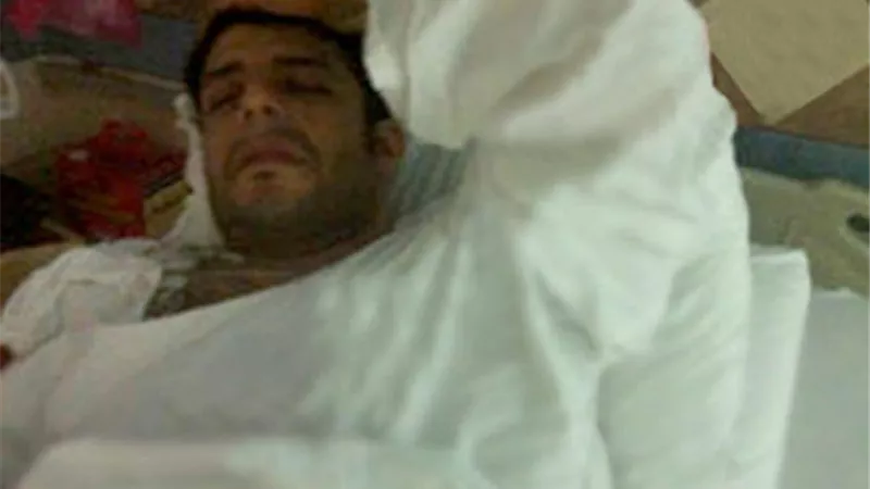 إصابة محمد حماقي في مباراة لكرة القدم ... صور