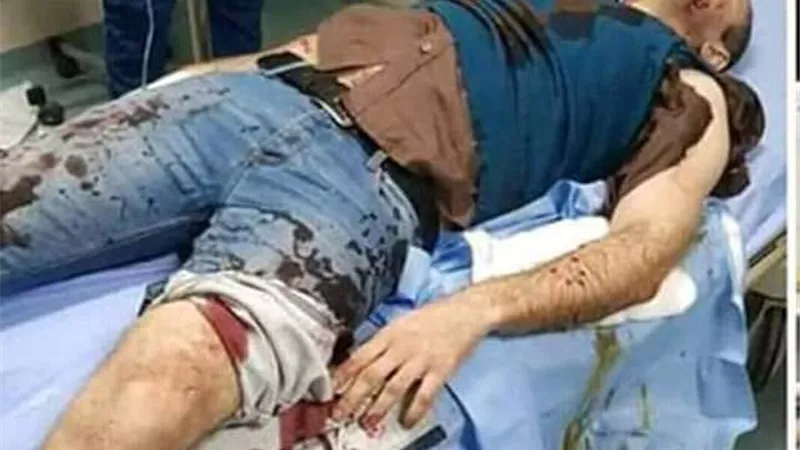 كلبان مفترسان يمزقان ضابط شرطة بالقاهرة الجديدة