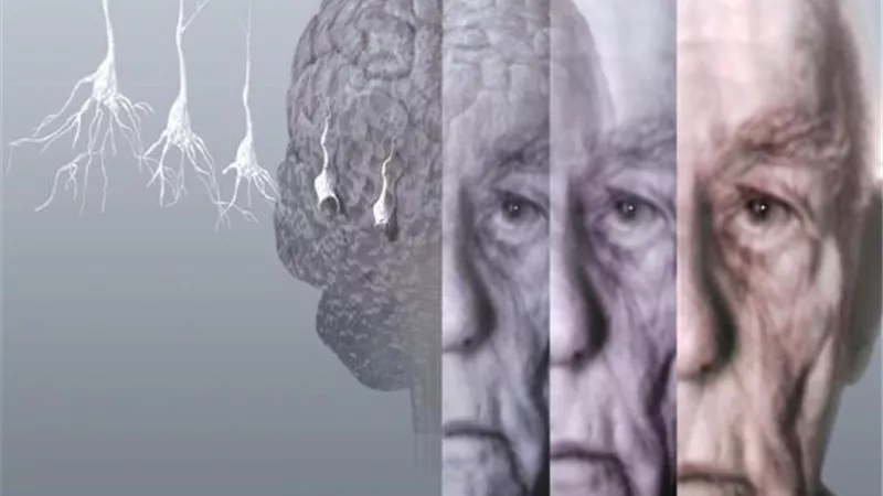 5 جينات جديدة تزيد خطر الإصابة بالزهايمر